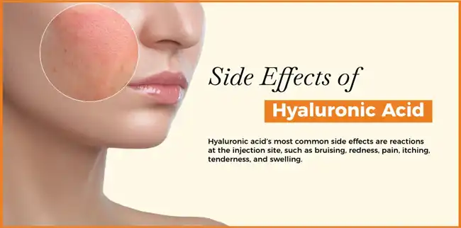Hyaluronic Acid Powder Hyaluronic Acid Powder