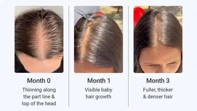 Allantoin FOR HAIR Allantoin FOR HAIR