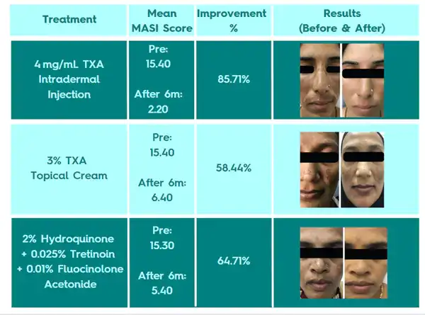 Tranexamic Acid Tranexamic Acid