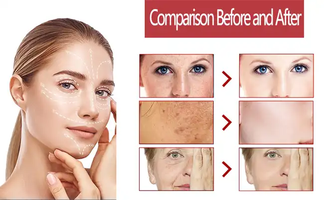 tranexamic acid powder tranexamic acid powder