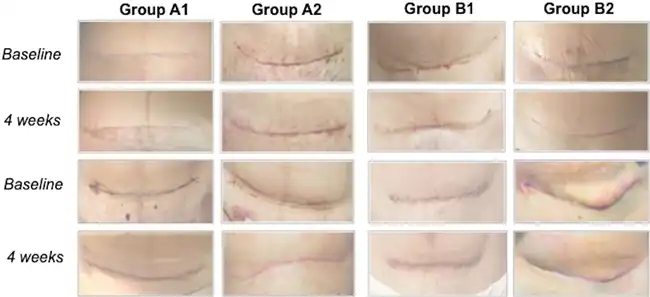 allantoin powder allantoin powder