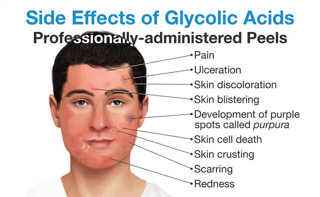 pure glycolic acid powder pure glycolic acid powder