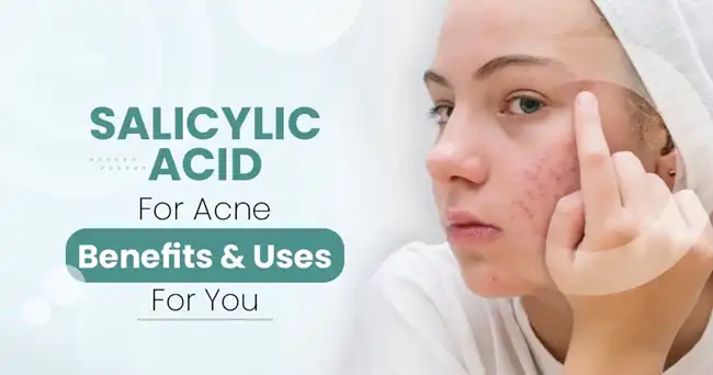 Salicylic acid for acne Salicylic acid for acne