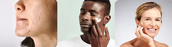 Glycolic Acid for Skin Glycolic Acid for Skin