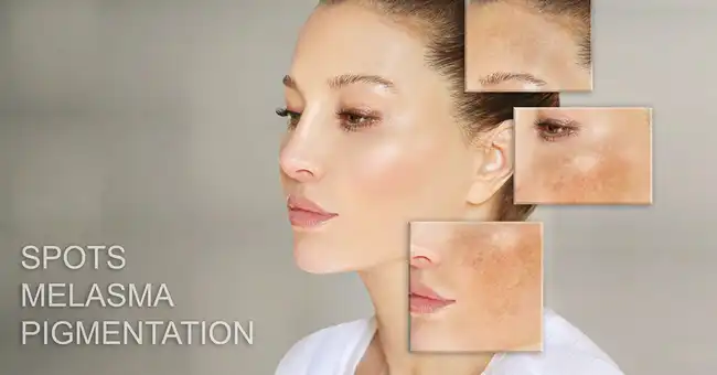 hydroquinone PURE POWDER hydroquinone PURE POWDER