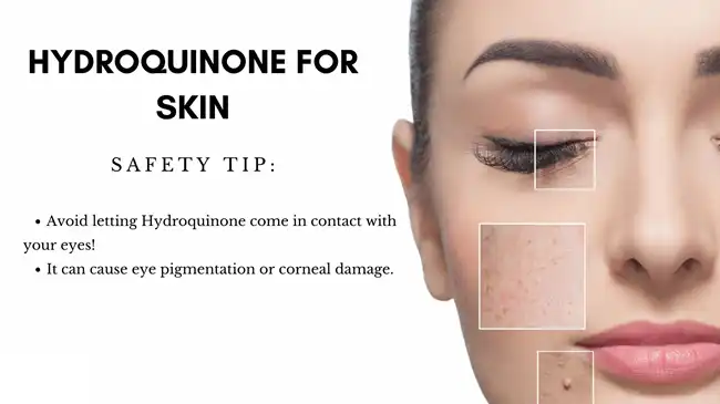 Hydroquinone for skin Hydroquinone for skin